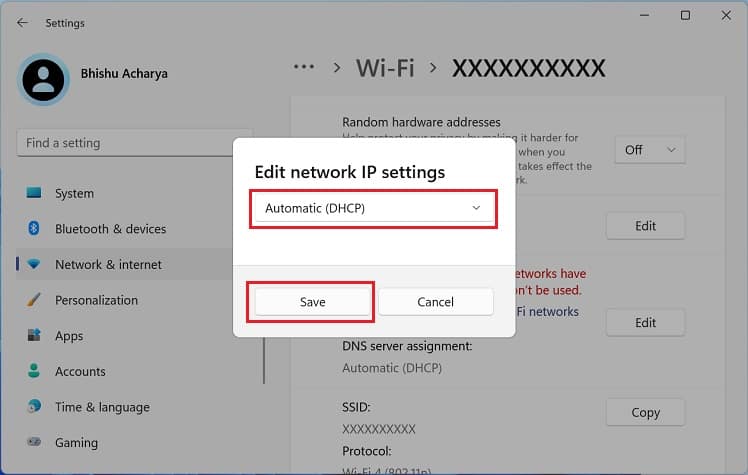automatic dhcp